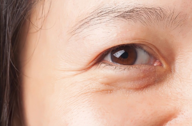 Mọi người cần để ý kỹ các triệu chứng của bọng mắt để có thể điều trị kịp thời, tránh hệ quả không đáng có