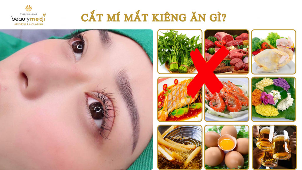 cắt mí mắt kiêng ăn gì