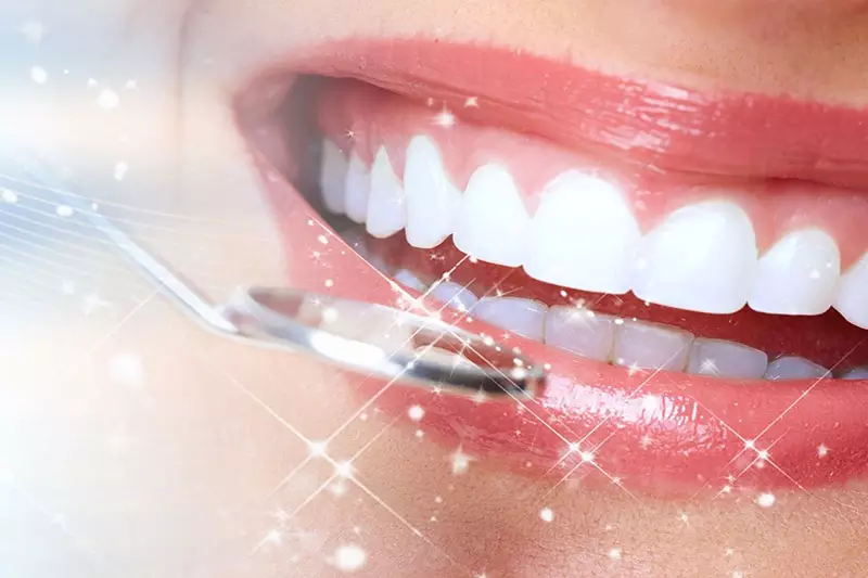 Dán răng sứ cũng tồn tại nhiều nhược điểm