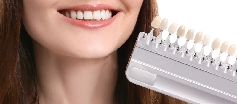 Một số trường hợp không nên dán răng sứ vì hiệu quả mang lại không cao
