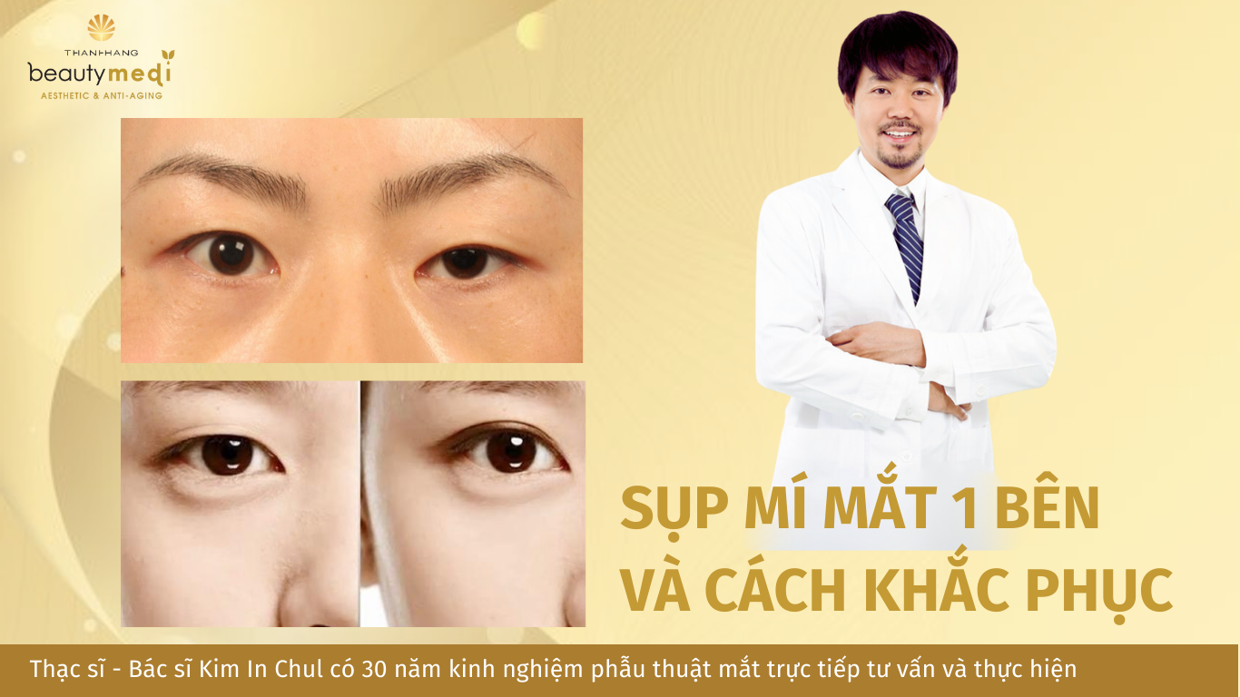 post_thumbnail