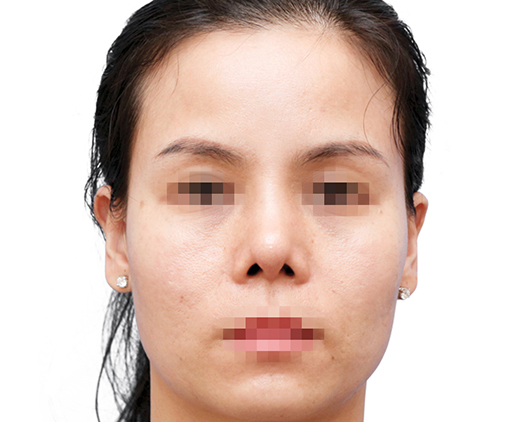 image_after