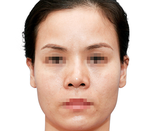 image_before
