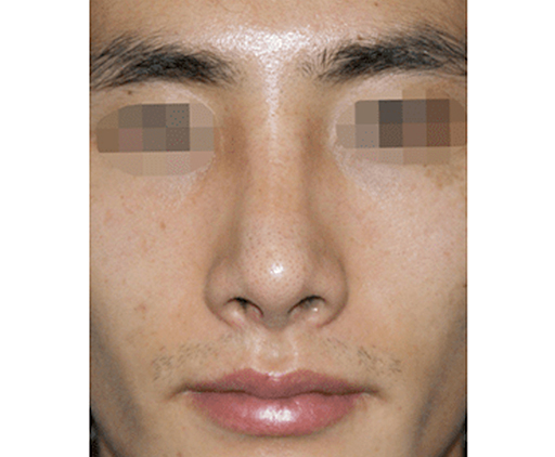 image_after