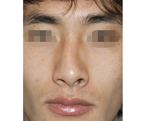 image_before