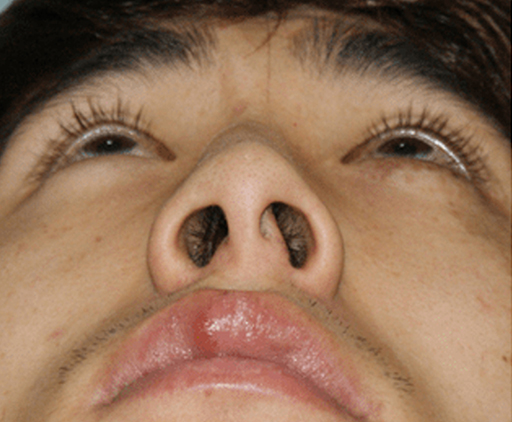 image_before