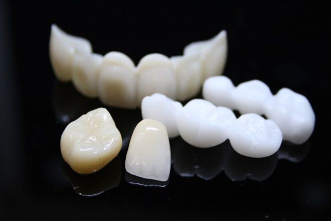 Bài viết dưới đây sẽ giải đáp câu hỏi của mọi người nên bọc răng sứ loại nào?
