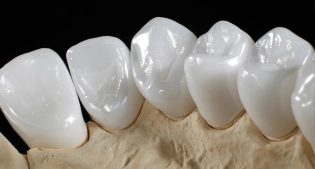 Răng sứ Zirconia là một loại răng toàn sứ cao cấp
