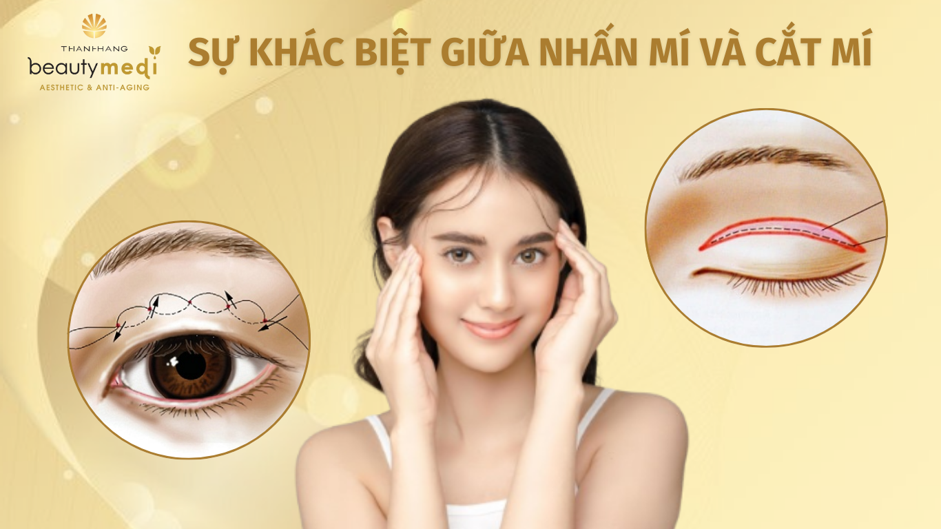 Sự khác nhau giữa cắt mí và nhấn mí