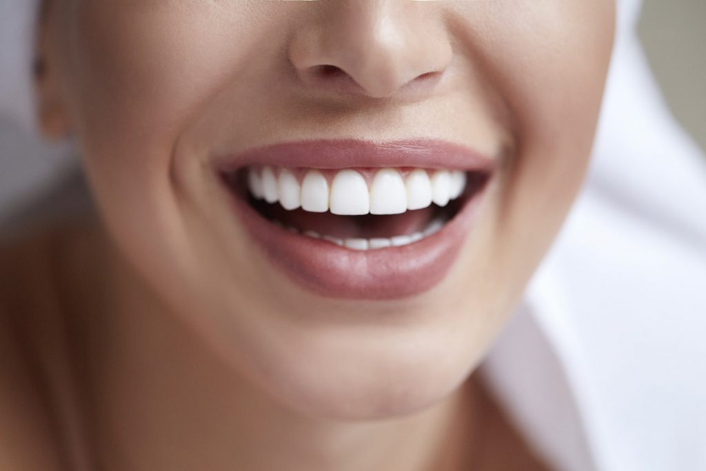 Răng sứ thẩm mỹ giúp cải thiện màu sắc và hình dạng răng