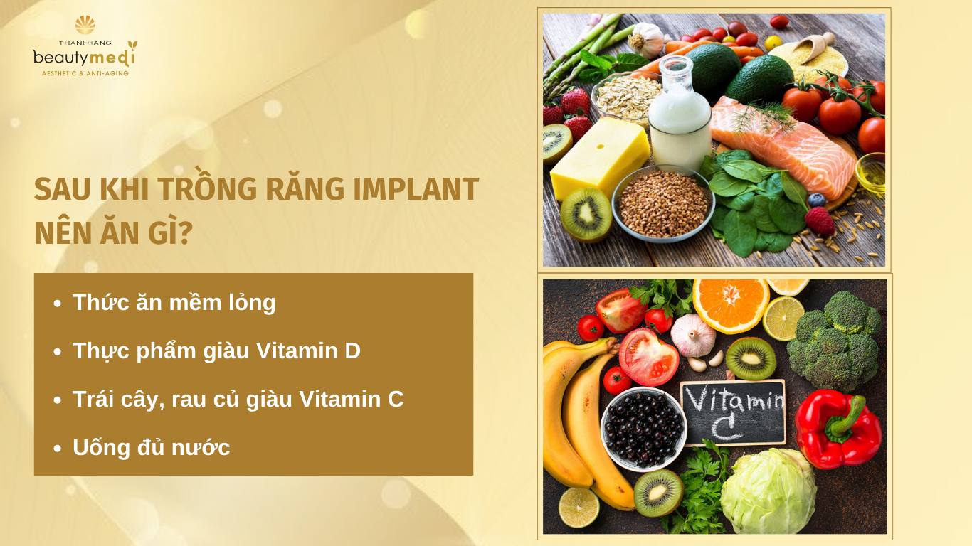 sau khi trồng răng implant nên ăn gì