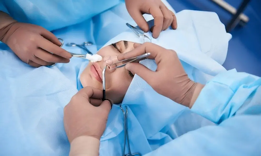 Sử dụng vật liệu hỗ trợ khi nâng mũi nếu da đầu mũi quá mỏng
