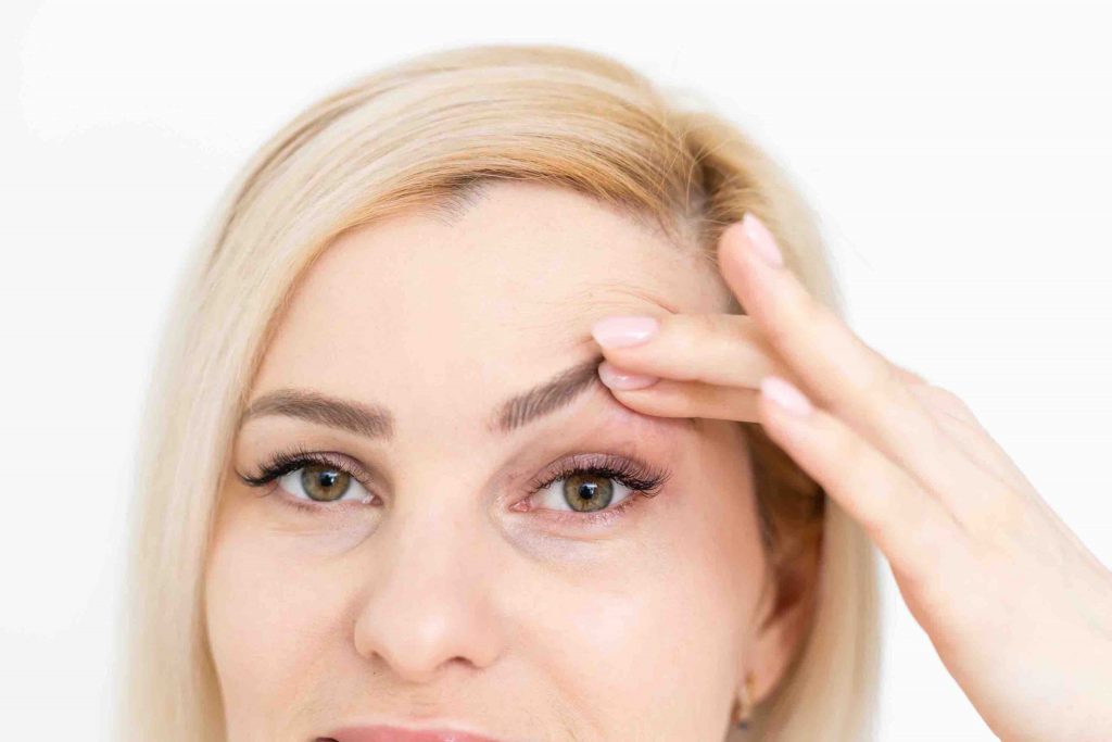 Sụp mí mắt 2 bên gây ảnh hưởng đến thẩm mỹ của toàn bộ khuôn mặt
