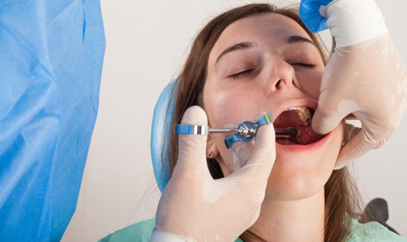 Tiêm thuốc tê sẽ làm giảm tình trạng đau nhức khi trồng răng Implant