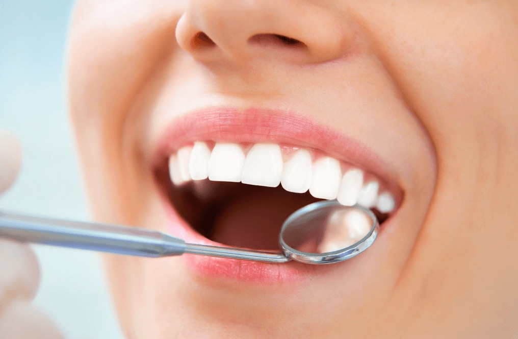 Tái khám để kiểm tra răng định kỳ sau khi bọc răng sứ 