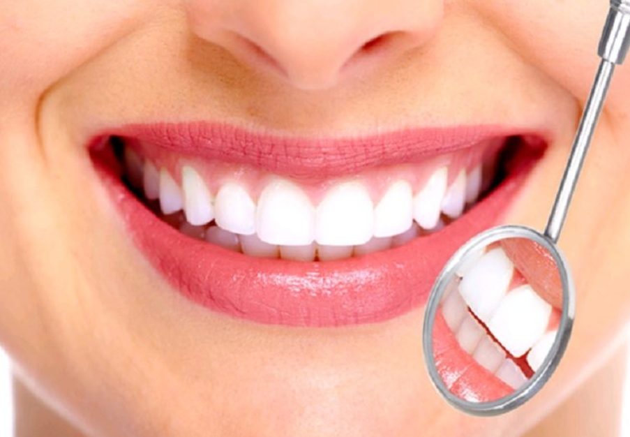 Bọc lại răng sứ giá bao nhiêu phụ thuộc nhiều yếu tố