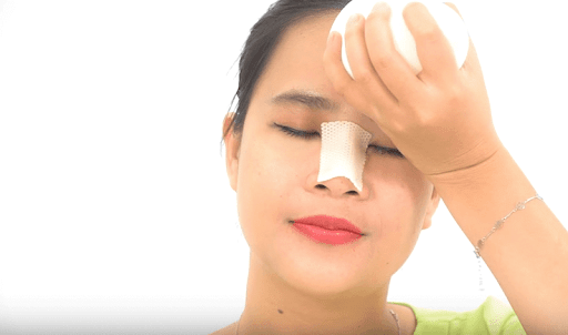 Sau phẫu thuật nâng mũi có thể chườm ấm hoặc chườm lạnh để giảm tình trạng sưng