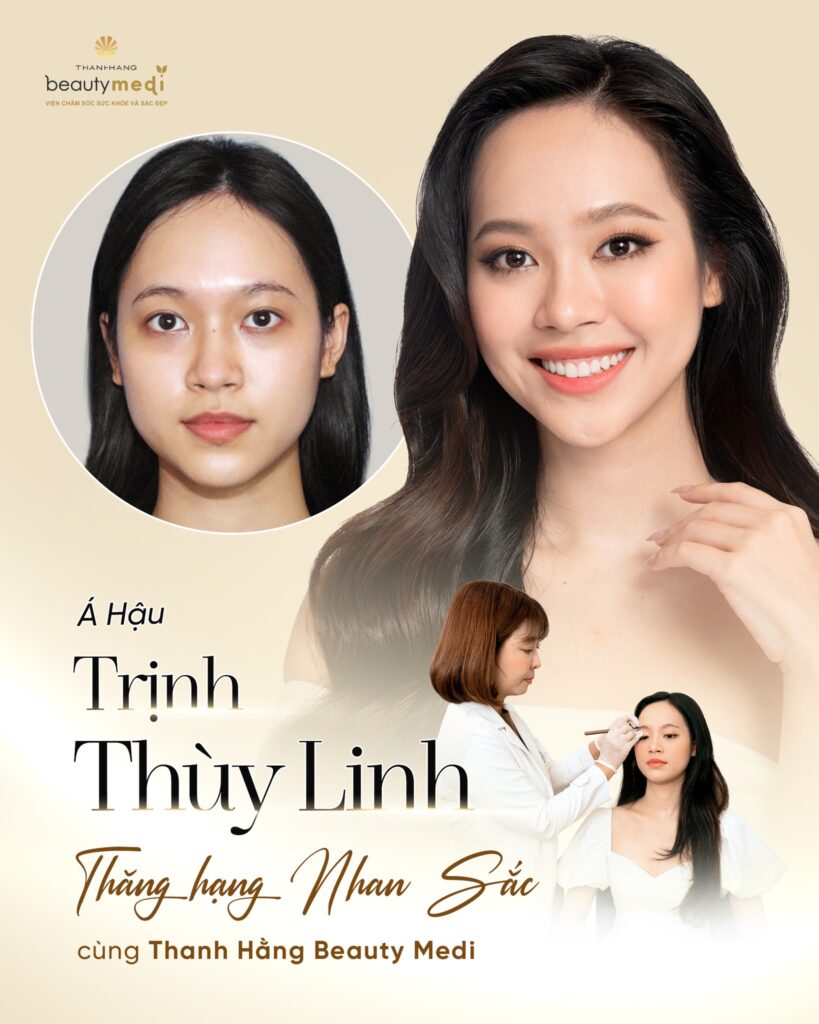 á hậu Trịnh thùy linh