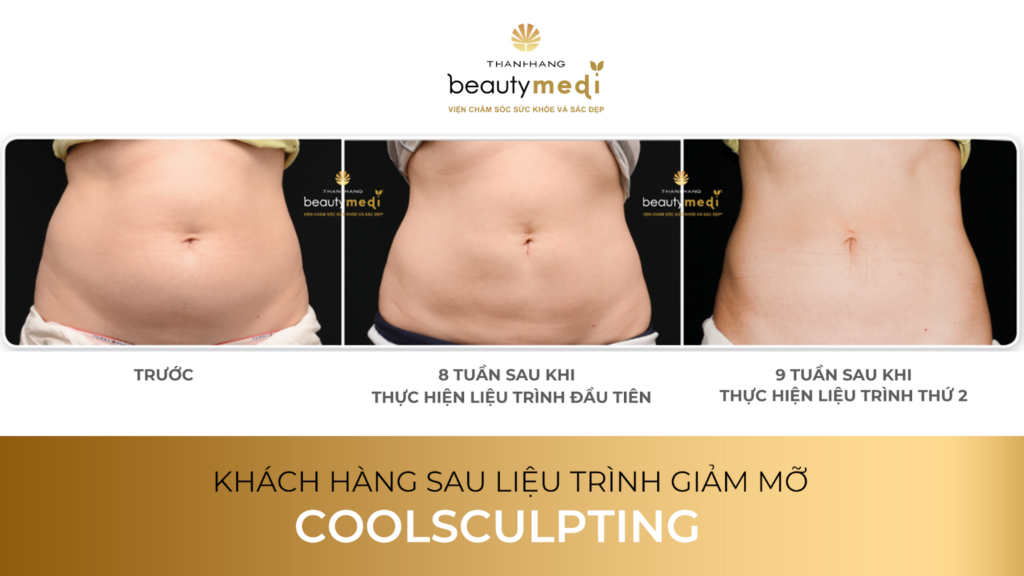 Hình ảnh khách hàng sử dụng liệu trình giảm mỡ 