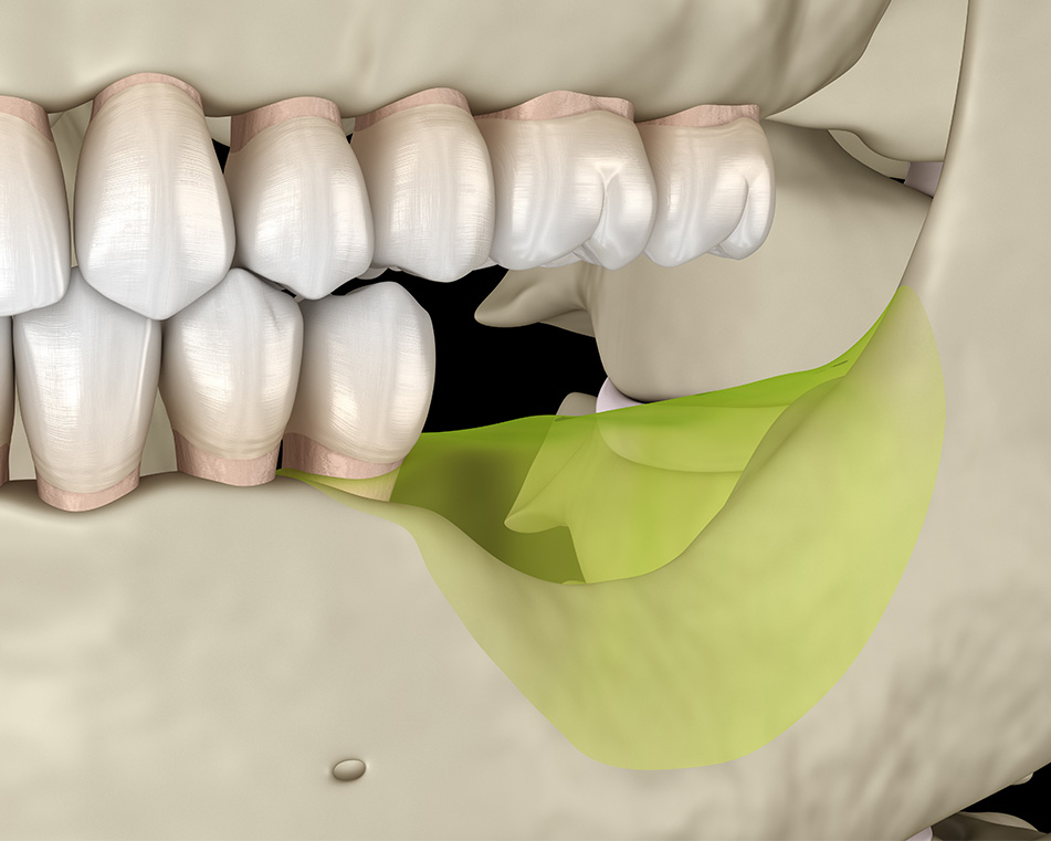 post_thumbnail