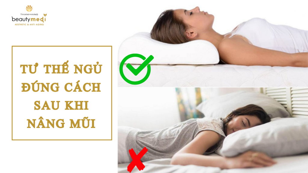 tư thế ngủ đúng cách sau nâng mũi