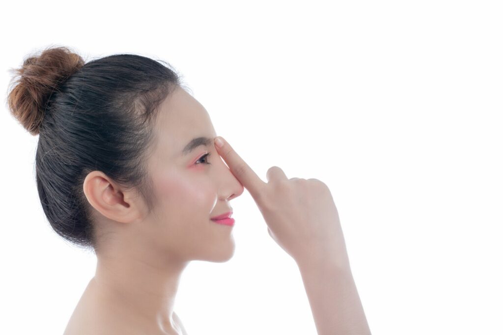 Nâng mũi cấu trúc khắc phục khuyết điểm dáng mũi cong vẹo
