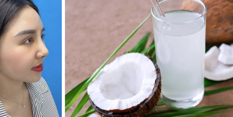 Nâng mũi uống nước dừa được không là thắc mắc của nhiều người