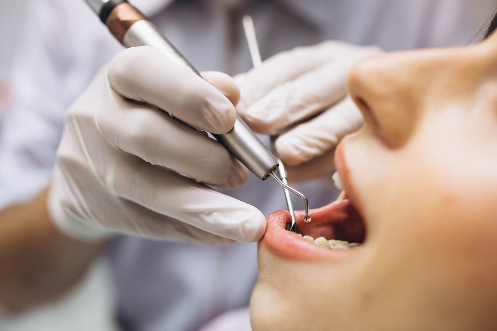 Bọc răng sứ là phương pháp chỉnh nha hiện đại đang được nhiều người lựa chọn