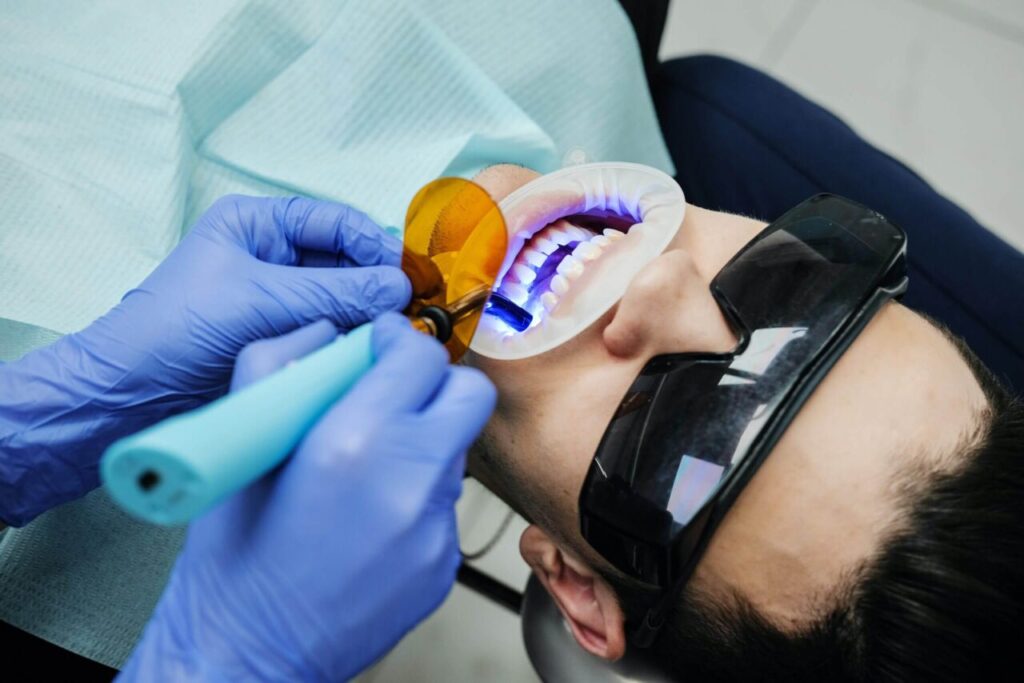 Cải thiện tình trạng răng xỉn màu bằng phương pháp tẩy trắng răng