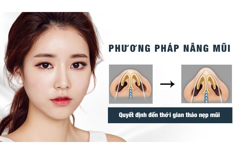 Tháo nẹp mũi sớm hay muộn còn phụ thuộc vào phương pháp nâng mũi