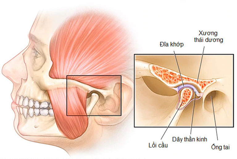 Loại sụn nâng mũi bằng sụn thái dương được nhiều chuyên gia lựa chọn