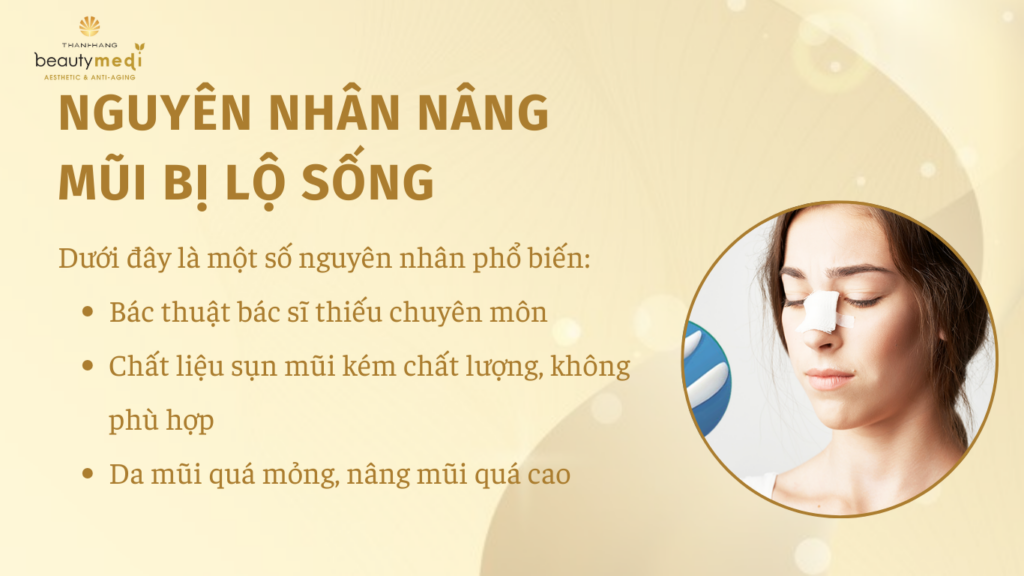 Dấu hiệu lộ sống mũi