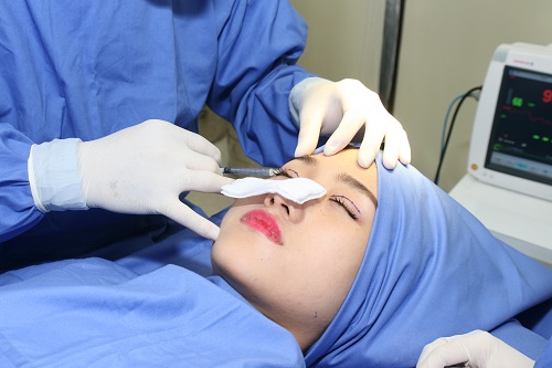 Nhiều người đều đặt câu hỏi “Cắt mí mắt bao lâu thì lành”