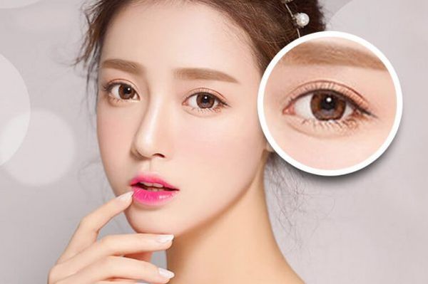 Mí mắt sẽ hết sưng trong khoảng 7-10 ngày, và cũng tùy thuộc vào cơ địa mỗi người