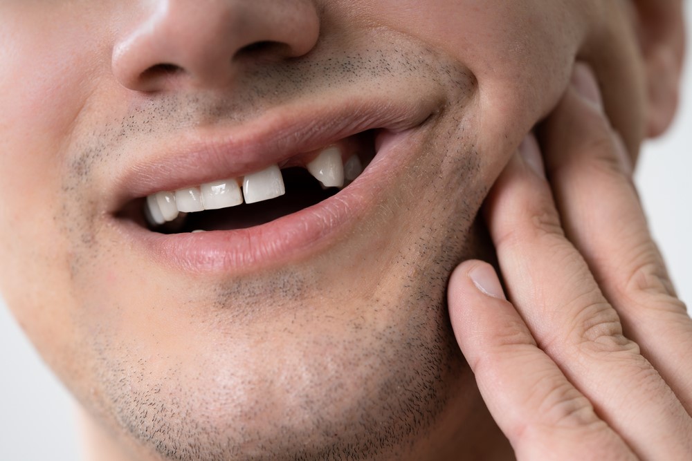 Răng bị lung lay chỉ có thể nhổ và trồng răng mới