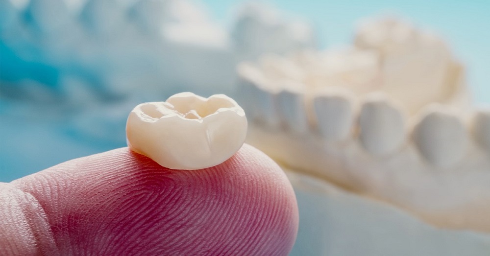 Răng sứ Zirconia giúp giảm nguy cơ kích ứng và viêm nhiễm