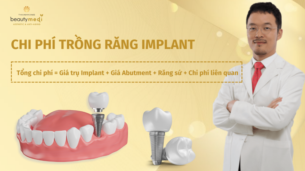 Chi phí trồng răng Implant hết bao nhiêu