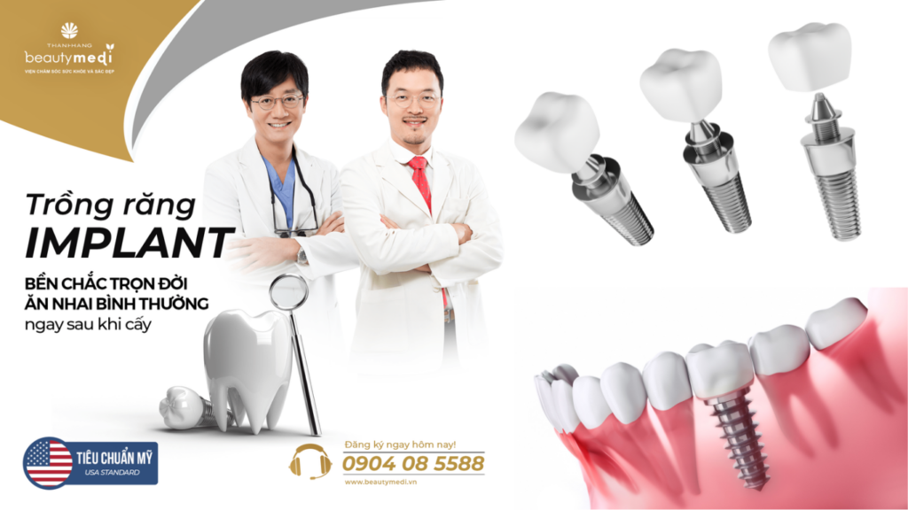 trồng răng implant tại Thanh Hằng Beauty Medi