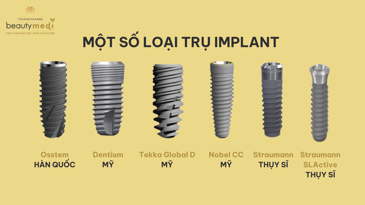 các loại trụ implant