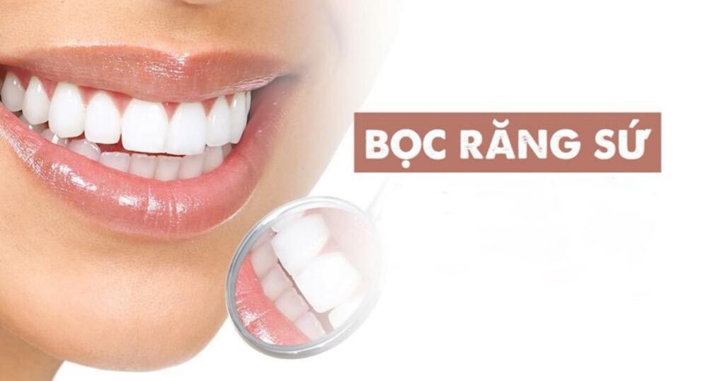 Bọc răng sứ có độ bền cao lên tới vài chục năm