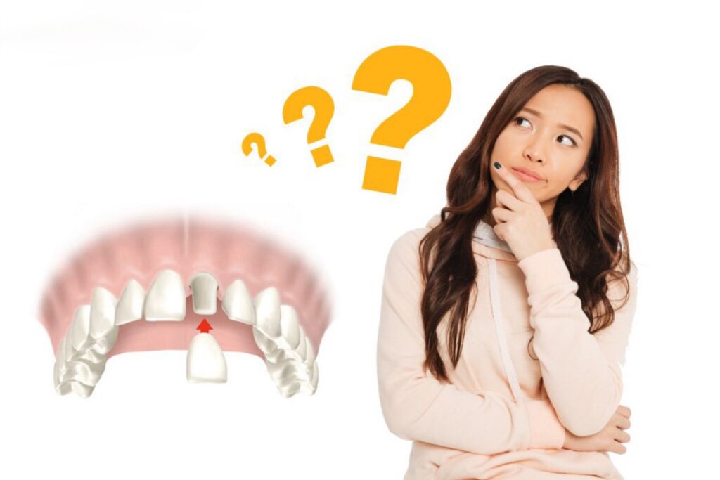 Độ tuổi lý tưởng để bọc răng sứ là trên 18 tuổi, khi răng đã phát triển toàn diện 