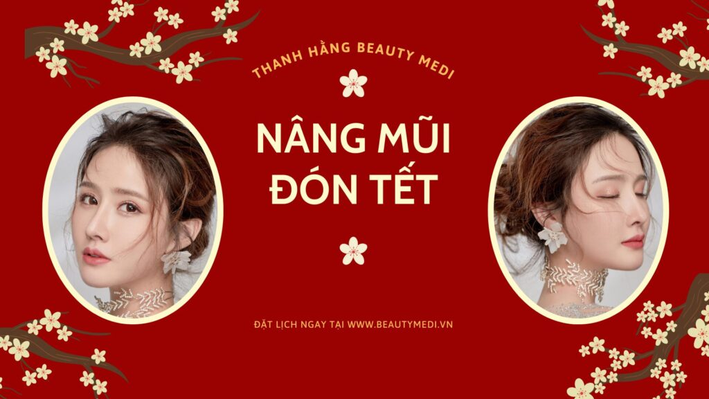 Nếu có ý định nâng mũi đón Tết thì cần thực hiện trước nghỉ lễ ít nhất 1 tháng