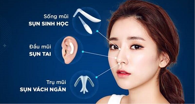 Cần tham khảo ý kiến bác sĩ trước khi chọn sụn nâng mũi